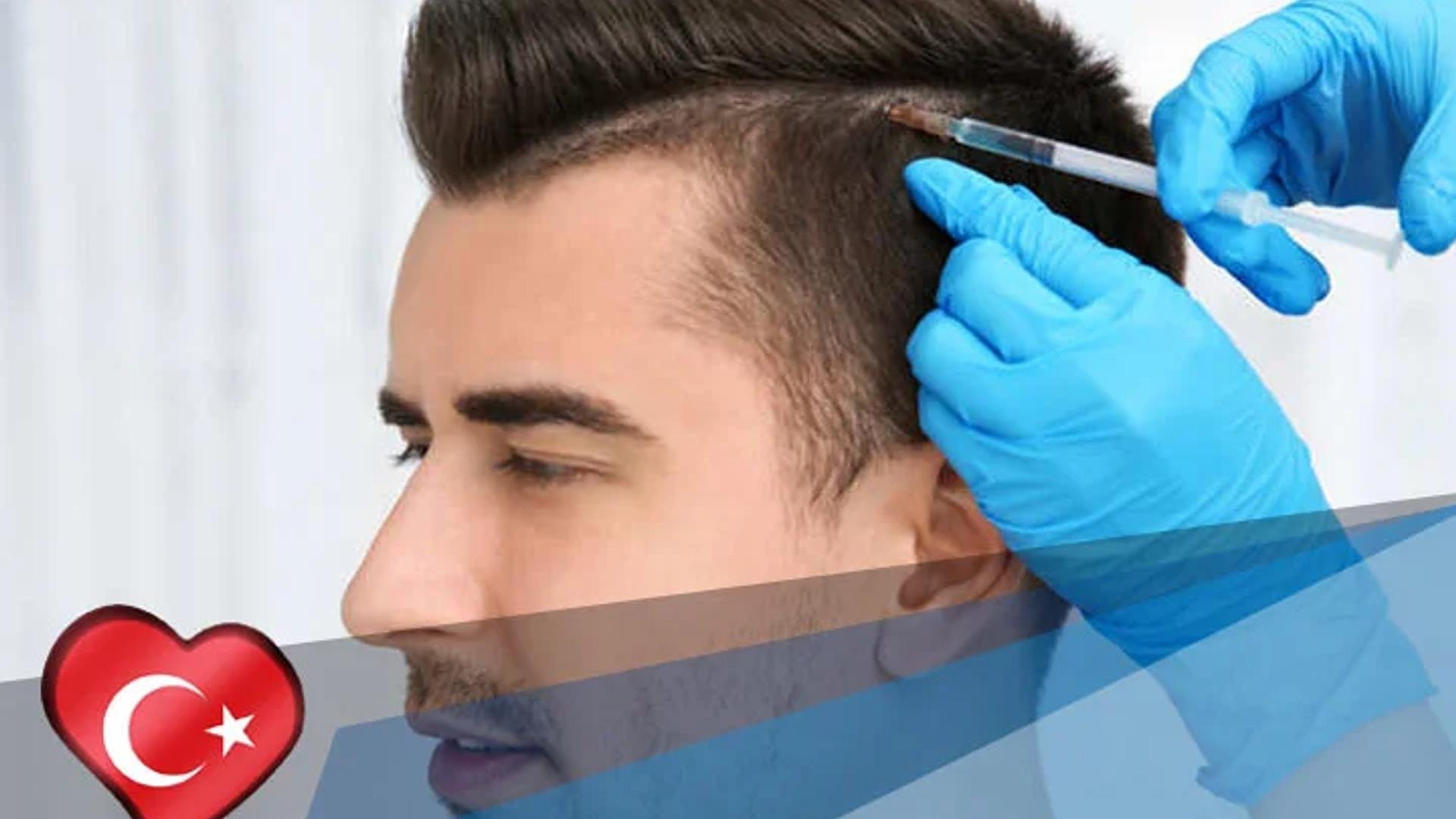 השתלת שיער בטורקיה